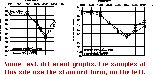 Hearing Test Chart