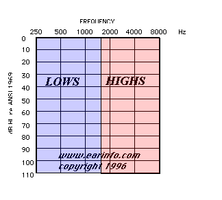 Normal Hearing Audiogram