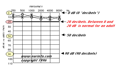 Hearing Level In Decibels Chart